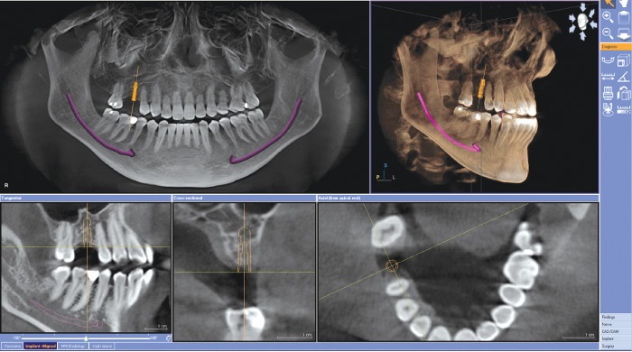 Galileos dental technology software images of teeth