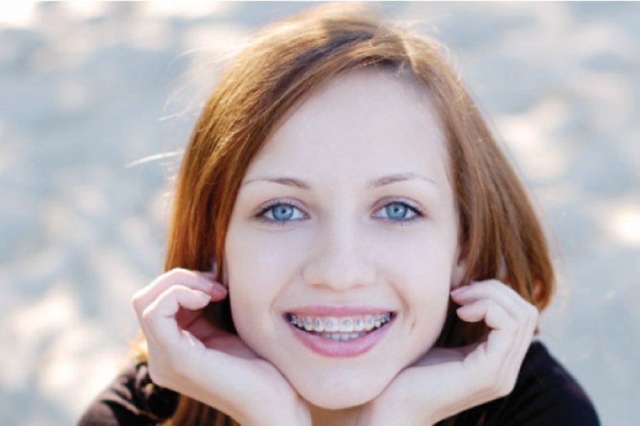 girl rests her chin on her hands and smiles to show off her braces