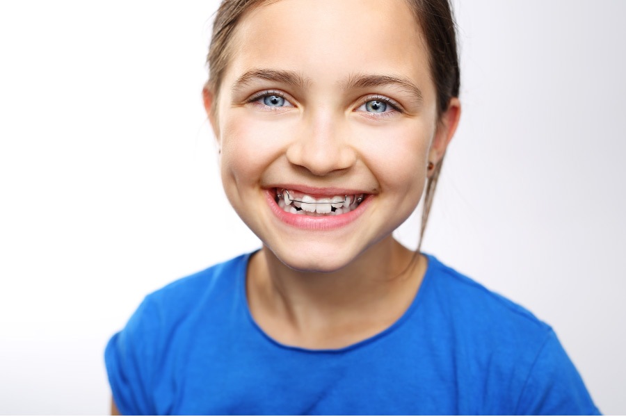 young girl smiling to show off her braces