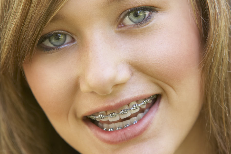 young woman smiles showing off her braces